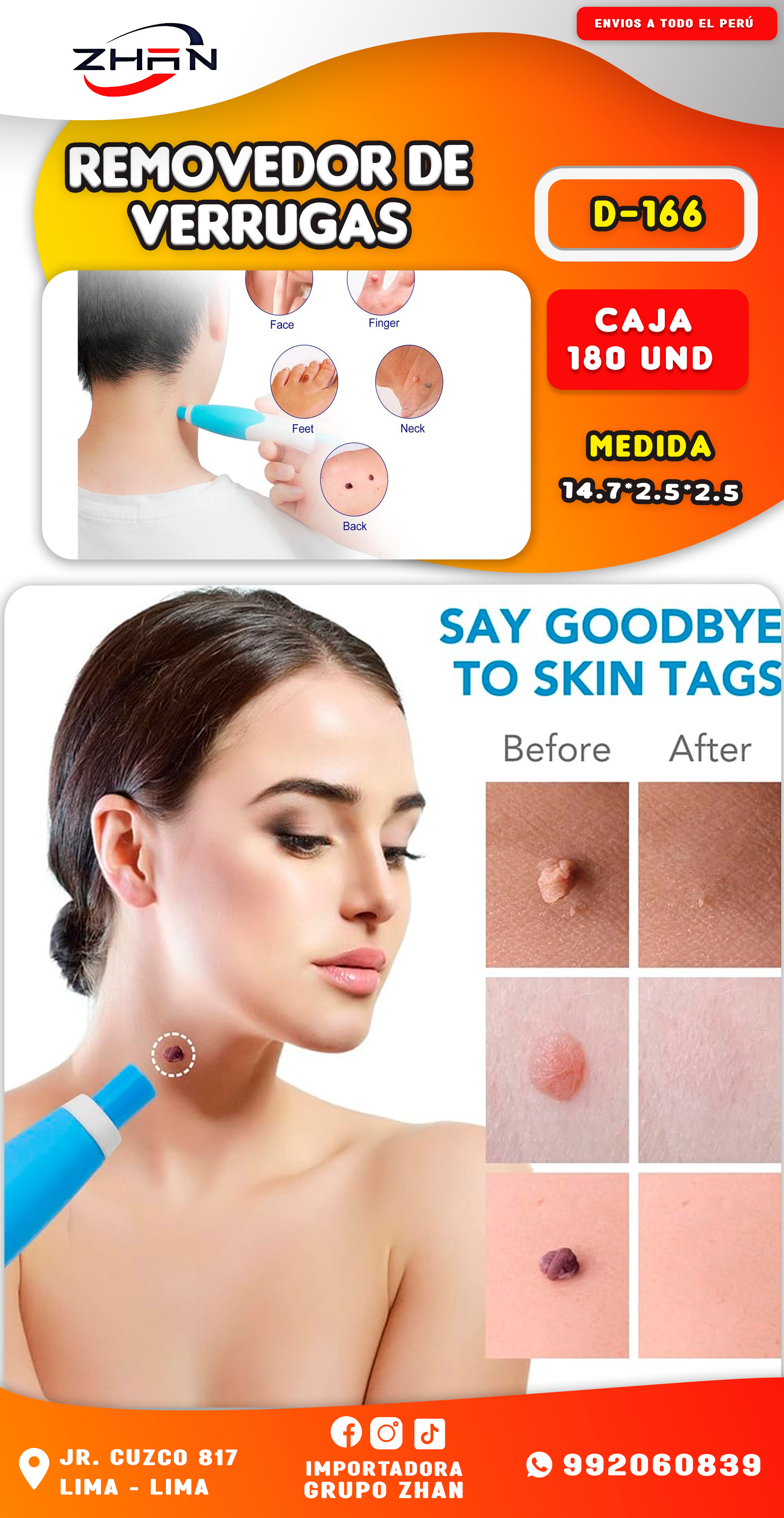 removedor de verrugas